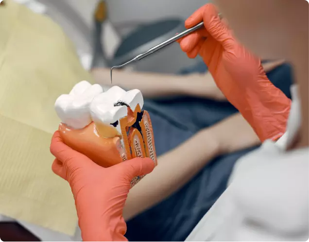 Tooth Extraction